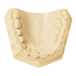 Resinrock Xl5 (WHipmix)