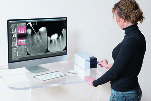 Owandy CR2 Digital Phosphor Plate Scanner