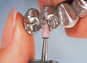 Lab Series Stones (Shofu)