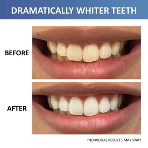 Crest 3D Whitestrips At Home Whitening Strips with LED Light Kit 