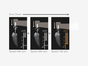 Tri Auto ZX2+ Endodontic Cordless Handpiece