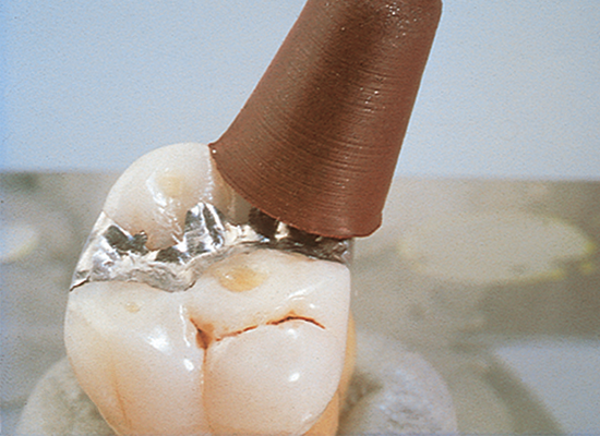 Brownie Polishers FG 12/Pkg (Shofu)