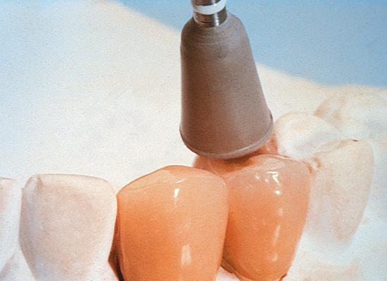 Ceramiste HP (Shofu)